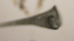 Stentor coeruleus