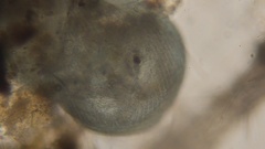 Stentor coeruleus