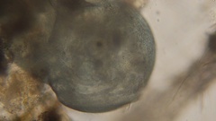 Stentor coeruleus