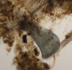 Stentor coeruleus