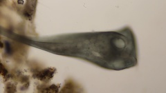 Stentor coeruleus
