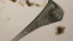 Stentor coeruleus