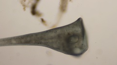 Stentor coeruleus