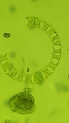 Eucampia zodiacus