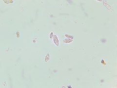 Scytinium intermedium