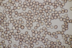 Microbotryum anomalum
