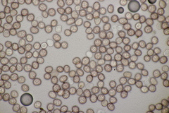 Microbotryum anomalum