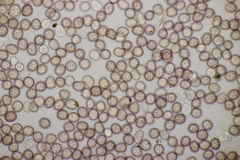 Microbotryum anomalum