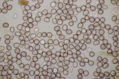 Microbotryum anomalum