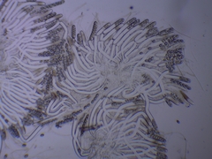 Adelphella babingtonii