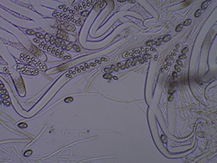 Adelphella babingtonii