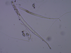 Adelphella babingtonii