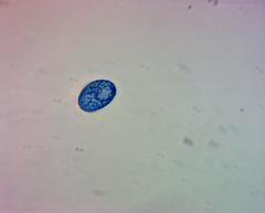 Scutellinia vitreola