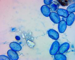 Scutellinia vitreola