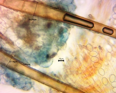 Scutellinia vitreola