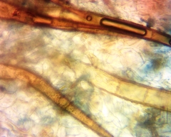 Scutellinia vitreola