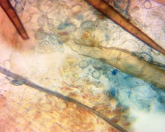 Scutellinia vitreola