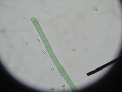 Planktothrix rubescens