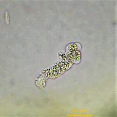Deuteramoeba algonquinensis