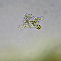 Deuteramoeba algonquinensis