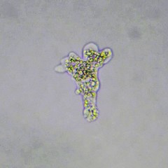 Deuteramoeba algonquinensis