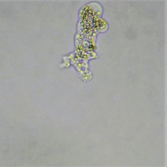 Deuteramoeba algonquinensis