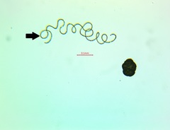 Dolichospermum