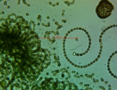 Anabaena