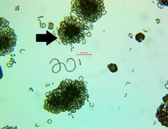 Anabaena