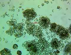 Dolichospermum