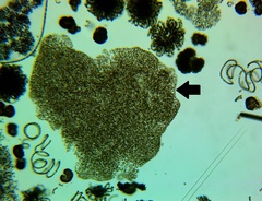 Microcystis