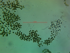 Microcystis