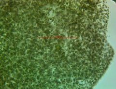 Microcystis