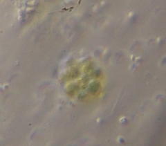 Coelastrum