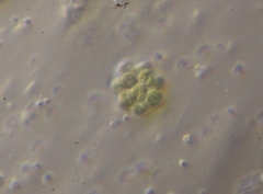 Coelastrum