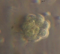 Coelastrum