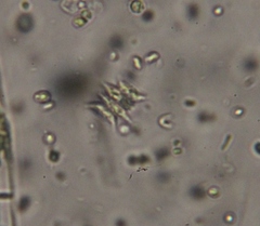 Scenedesmaceae