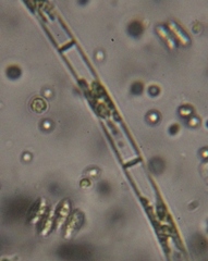 Scenedesmaceae