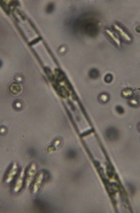 Scenedesmaceae