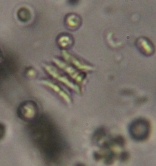 Scenedesmaceae