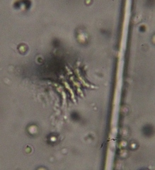 Scenedesmaceae