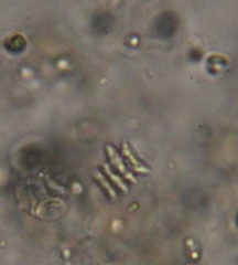 Scenedesmaceae