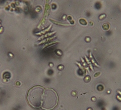 Scenedesmaceae