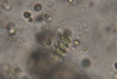 Scenedesmaceae