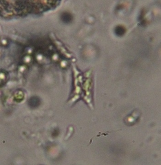 Scenedesmaceae