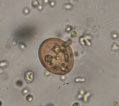 Arcellinida