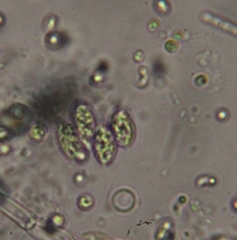 Scenedesmaceae