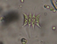 Scenedesmaceae