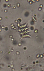 Scenedesmaceae