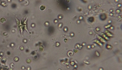 Scenedesmus